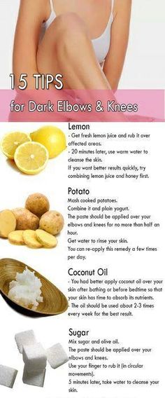 Dark Elbows And Knees, Dark Knees, Dark Elbows, Beauty Remedies, Skin Remedies, Skin Care Remedies, Natural Beauty Tips, Organic Skin, Diy Skin Care