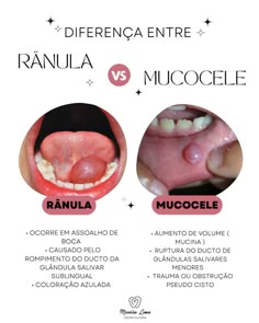 Estomatologia Dental Videos, Medicine Notes, Dentistry Student, Dental Health Care, Dental Anatomy, Dental Fillings, Dental Life, Medical School Studying, Dental Art