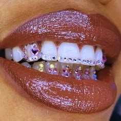 Tooth Jewelry is painless, non-evasive, and requires absolutely no drilling!! Lasts 2-3 years with proper care. Book your Service NOW! Canine Tooth Gem, Opal Tooth Gem, Tooth Gems Black Women, Girly Grillz, Perfect Teeth Braces, Tooth Gems Aesthetic, Tooth Gem Placement, Gap Grillz, Tooth Gem Designs