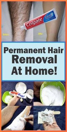 Permanent Hair Removal At Home, Male Hair Removal, Unwanted Facial Hair Removal, Brazilian Hair Removal, Best Permanent Hair Removal, Chin Hair Removal, Upper Lip Hair Removal, Back Hair Removal, Female Facial Hair