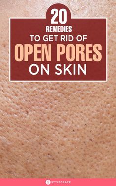 Get Rid Of Pores, Lotion For Oily Skin, Home Remedies For Skin, Face Pores, Open Pores, Diy Facial, Clear Pores, Spots On Face, Healthy Advice