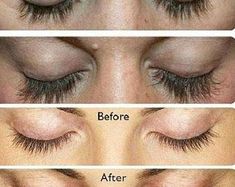 Check out our eyelash growth serum selection for the very best in unique or custom, handmade pieces from our eyelashes & mascara shops. Grow Lashes, Dried Rose Petals, Natural Eyelashes