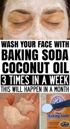 Coconut Oil And Baking Soda, Baking Soda Coconut Oil, Obličejové Masky, Baking Soda Shampoo, Beauty Tips For Face, Beauty Cream, Diet Keto, Health And Beauty Tips