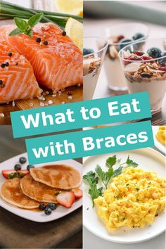 Good Food To Eat With Braces, Soft Food Braces Ideas, Meals For Braces Dinners, Meals For People With Braces, Dinner Ideas For Braces Soft Foods, Lunch Ideas For Braces, Soft Foods After Braces Ideas, Braces Meal Ideas