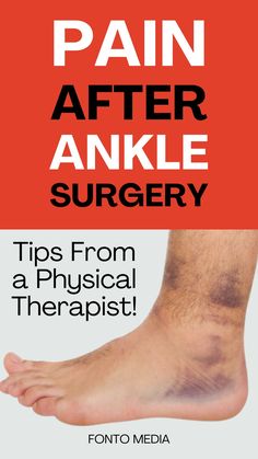 Ankle Surgery Recovery, Ankle Fracture, Rehab Exercises, Running Techniques, Ankle Surgery, Broken Ankle, Therapy Exercises