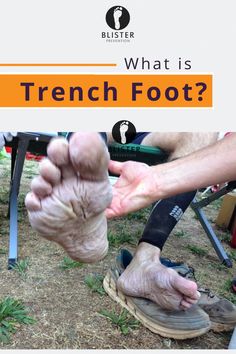 Foot blisters are a very common injury. But do you know what causes blisters on feet? Watch our videos to find out the best blister prevention & treatments. Trench Warfare, Best Hiking Gear, Layers Of The Epidermis, Running Injuries, Skin Images, Foot Injury, Skin Structure, Sports Injury, Hiking Tips