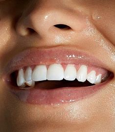 Whiten Teeth Fast, Peroxide Teeth Whitening, Pretty Teeth, Beautiful Teeth, Teeth Whitening Gel, Straight Teeth, Perfect Teeth, Nice Teeth