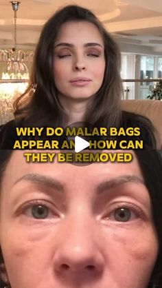 Malar Bags, Fasting Lifestyle, Face Fitness, Fluid Retention, Natural Aging, Facial Exercises, Facial Muscles, Aging Process, Fitness Coach