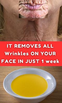 IT REMOVES ALL Wrinkles ON YOUR FACE IN JUST 1 week #WrinkleFreeLiving #RadiantBeauty #ForeverFlawless #GlowingYouth #YouthfulSkinGoals Natural Anti Wrinkle Skin Care, Best Natural Wrinkle Remedy, How To Avoid Wrinkles On Face, Best Foundation For Wrinkles, Wrinkle Remedies Face, All Natural Wrinkle Remedies, Wrinkle Prevention