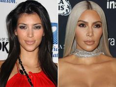 Kim Kardashian, Before and After - The Skincare Edit Before And After Contouring, Kim Before And After, Botox Before And After, Kardashian Beauty, Face Surgery, Rhinoplasty Before And After, Celebrity Costumes, Kim Basinger