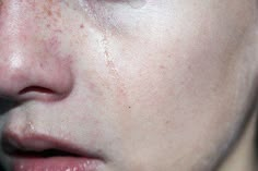 a close up of a person with freckles on their face