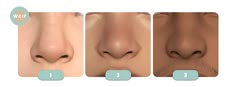 the stages of nose surgery are shown