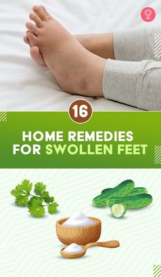 Reduce Swelling In Feet Remedies, Burning Feet Remedies, Swollen Legs Remedies, Swollen Feet Remedies, Bladder Exercises, Home Remedies For Warts