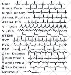 EKG Strip file for the cardiac lover in your life.  This is a DIGITAL SVG FILE ONLY, no physical item will be sent.  - Once you have completed your purchase, a link to download will be sent to the e-mail account registered to your Etsy account. - Design can be downloaded and cut with any silhouette, cricut, or other scan and cut. - Please do not resell or share the digital files. ⚠️ - Digital files CANNOT BE REFUNDED. If you have any problems, concerns and queries with your downloads, feel free Cardiac Health, Ekg Tech, Cardiac Nurse, Ekg Technician, Er Tech, Ekg Interpretation Made Easy, Ekg Technician Aesthetic