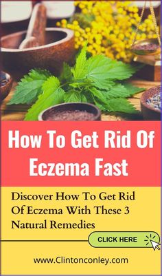 Eczema is a condition in which patches of skin become rough and inflamed, with blisters that cause itching and bleeding. Eczema is atopic dermatitis which is inflammation of the skin. What causes the skin to be inflamed you ask? #eczema #eczemarelief #eczemaproblems #EczemaTreatment #Eczemachildren #eczemacare #eczemacure #eczemasolution #eczemarecovery #eczemakids #eczemaholistichealing #eczemawarrior Home Remedies For Allergies, Warts Remedy, Natural Remedies For Migraines, Acne Help, Dry Skin Remedies, Home Remedies For Hair, Dry Skin Care, Skin Care Remedies, Natural Remedies