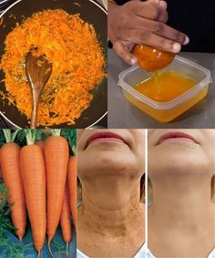 Farm Show Farm Show, Natural Remedies, Wrinkles, Anti Aging