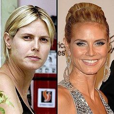 #plasticsurgery #plasticsurgerygonewrong #beforeafter #celebritiesbeforeafter #hollywoodstars #bignosesurgery #surgery #facesurgery #vlinesurgery #koreanplasticsurgery #kpopplasticsurgery #nosejob #jawreductionsurgery #eyesurgery #cheekfillers #rhinoplasty #facelift #plasticsurgeryfails #expensiveplasticsurgery Makeup Photoshop, Celebs Without Makeup, Makeup Before And After, Celebrity Plastic Surgery, Actress Without Makeup, Hooded Eye Makeup, Makeup Transformation