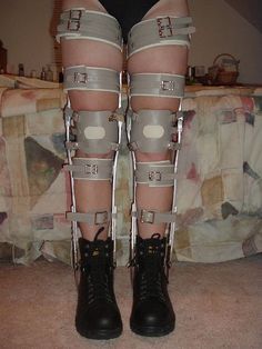 Kafo Leg Braces, Amputee Oc, Disabled Oc, Milwaukee Brace, Jhin League Of Legends, Orthopedic Brace, Braces Girls, Prosthetic Leg, Leg Braces