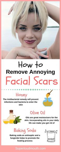 Acne Scab, Get Rid Of Hormonal Acne, Shoulder Acne, Olive Oil Skin, Chest Acne, Forehead Acne, Back Acne, Acne Products, Pimples Overnight