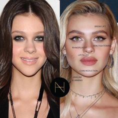 Nicola Anne Peltz, Face Injections, Chin Reduction, Forehead Lift, Rhinoplasty Nose Jobs, Botox Face, Nicola Peltz