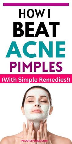 Pimple Remedies Overnight, Face Pimples, Pimples On Scalp, Back Acne Remedies, Blind Pimple