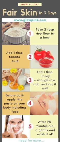 Skin Whitener, Stretch Mark Removal Cream, Teeth Whiting At Home, Back Acne Remedies, Cystic Acne Remedies, Blind Pimple, Teeth Whitening Homemade, Pimples Under The Skin, Teeth Whitening Remedies