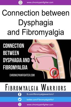 Fibermyalgia Symptoms, Daily Health Tips, Fitness Advice, Chronic Fatigue, Autoimmune Disease, Health And Fitness Tips, Health Advice