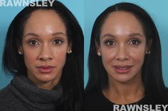 Ethnic Features, Celebrity Plastic Surgery, Facial Plastic