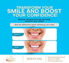 If you are not happy with your smile and believe that teeth whitening can improve your smile and give you that edge, talk to us at (678) 374-3764. We will help you achieve your dental goals 😁✨ #TeethWhitening #smyrna #GA #smyrnadental Teeth Whitening Procedure, Dental Posts, Discolored Teeth, Dental Art, General Dentistry, Oral Health Care