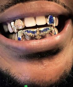 Diamond Teeth, Custom Grillz, Dope Jewelry Accessories, Gold Grillz, Gold Teeth