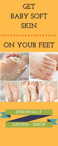 basic homemade recipe for removing dead and dry skin from feet. This will peel off and remove the dried layer and make your skin baby soft and fair. Baby Soft Skin, Homemade Recipe, Epsom Salt, Homemade Skin Care, Soft Skin, Skin So Soft, Skin Treatments, Beautiful Skin