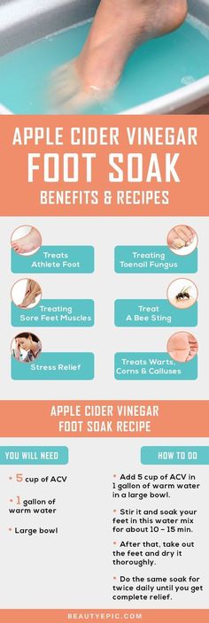 Apple Cider Vinegar Foot Soak – Benefits and Recipes by jackie Vinegar Foot Soak, Apple Cider Vinegar Foot Soak, Foot Soak Recipe, Foot Soak, Herbal Remedies, Healthy Tips