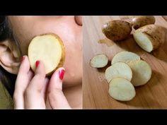 Potato Face Mask, Dark Spots Under Eyes, Removing Hyperpigmentation, Dark Spots On Legs, Potato Face, Dark Spots Remedies, Makeup Recipes, Spots On Legs, Acne Dark Spots