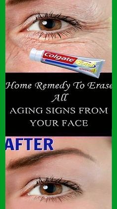 Can [Ingredient] Really Reverse Aging? The Results... Skin Tightening Essential Oil, 2024 Health, Skin Improvement, Natural Repellent, Face Tips, Tighten Skin, Eye Creme