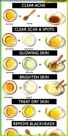 You can easily get rid of these blackheads by using natural or home remedies for blackhead treatment. Click to read How to get rid of blackheads diy| The best blackheads removal on nose| get rid of blackhads on face| get rid of blackheads on nose| how to get rid of blackheads naturally Getting Rid Of Scars, Haut Routine, Honey Face Mask, Clear Healthy Skin, Honey Face, Face Acne, Homemade Face