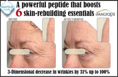 Ageless Retinol Moisturizing Cream by iMagique for just $14.99 Wrinkle Filler