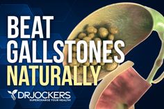 How to Beat GallStones Naturally - DrJockers.com Gall Stones Symptoms Gallstone, Gallstone Diet Gallbladder Cleanse, Gallstone Symptoms, Gallstone Cleanse, Gallbladder Health