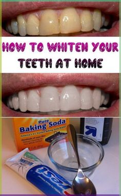 teeth with toothpaste and baking soda on the bottom, below it is an image of how to whiten your teeth at home