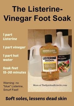 Vinegar Foot Soak, Pedicure Soak, Diy Remedies, Women Body, Pedicures, Foot Care