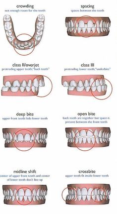 Dental Assistant School, Dental Assistant Study, Dental Hygiene Student, Dental Videos, Kedokteran Gigi, Dentistry Student, Dental Anatomy