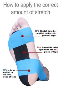 Plantar Fasciitis | Plantar fasciitis taping, Kinesiology taping, Plantar fasciitis Facitis Plantar, Foot Pain Relief Remedies, K Tape, Pain Relief Remedies, Kinesio Taping, Kinesiology Taping, Natural Pain Relief