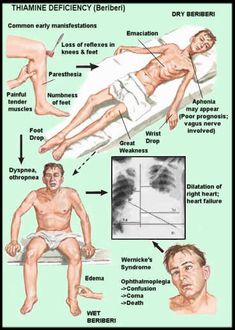 a diagram showing the different types of nematia in humans and their respective body