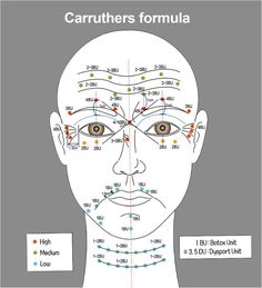 Face Diagram, Botox Injection Sites, Botox Training, Facial Injections, Botox Injection, Botulinum Toxin