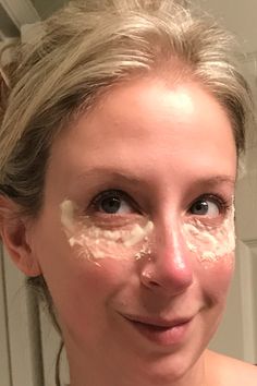 Fight under eye bags and look younger in 20 minutes by using a combo of baking soda and lemon juice paste 1-2 x's per week. Baking Soda And Lemon, Pretty Life, Baking Soda Uses, Baking Soda Shampoo, Under Eye Bags, Natural Therapy, Natural Beauty Tips, Eye Bags, Years Younger