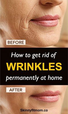 How To Get Rid Of Wrinkles and Spots By Just Using This At Home >>CHECK THIS OUT<< Bloated Stomach, Wrinkle Reduction, Under Eye Bags, Deep Wrinkles, Youthful Skin