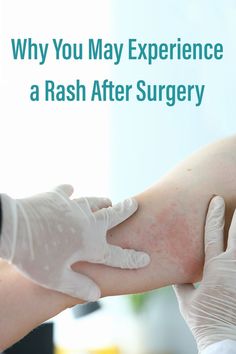 Having surgery means being exposed to various materials and medications. According to The National Eczema Association some patients may experience a rash called contact dermatitis. Learn more: Types Of Rashes, Common Medications, Blood Pressure Cuff, Emergency Care, After Surgery, Dermatology, The National, Surgery