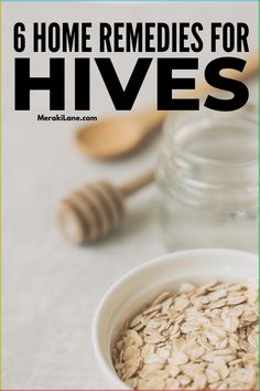 How to Get Rid of Hives | Whether your hives (or urticaria) are chronic or acute, caused by a histamine intolerance, an allergic reaction, or stress, finding relief for this itchy and irritating rash is important. In this post, we share everything you need to know - the signs and symptoms of hives, common causes, and natural remedies for fast relief. From at-home treatments like oatmeal and baking soda baths, witch hazel, cold compresses, and more, these home remedies work! Natural Hives Remedy, Oatmeal Bath For Hives, Get Rid Of Hives Fast, Face Rash Remedies How To Get Rid, Natural Itch Relief Skin, Itchy Rash Remedies, Allergic Reaction Rash Remedies, Allergic Reaction Remedies