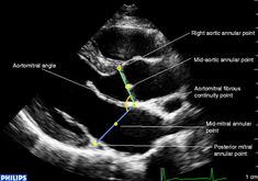 an x - ray shows the location of the diaper and its corresponding features in this image