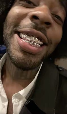 a close up of a person with braces on his teeth and wearing a hat