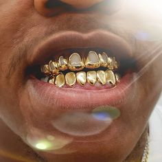 Leojewelers. www.instagram.com/leojeweler Girl Grillz, Pretty Teeth, Dental Jewelry, Grillz Teeth, Gold Grill, Custom Grillz, Streetwear Jewelry, Dope Jewelry Accessories, Gold Grillz